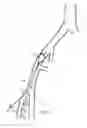 Fig. 08 - Bidirectional Introducer Catheter