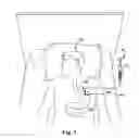 Fig. 02 - Interlock feed set coupling