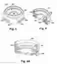 Fig. 04 - Interlock feed set coupling