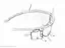 Fig. 01 - Visual prosthetic apparatus for retinal stimulation