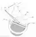 Fig. 01 - Methods and systems for lowering blood pressure through reduction of ventricle filling
