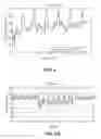 Fig. 04 - Methods and systems for lowering blood pressure through reduction of ventricle filling