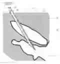 Fig. 01 - Apparatus and method for optimized stimulation of a neurological target