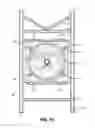 Fig. 09 - Exercise sled and backpack combination