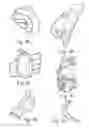 Fig. 09 - Patient aid devices, particularly for mobile upper extremity support in railed devices such as parallel bars and treadmills
