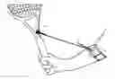 Fig. 01 - Swing sport instrument training device and method of using same