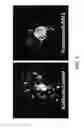 Fig. 22 - System and method for a biomimetic fluid processing