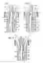 Fig. 02 - MULTIPLE CASTING APPARATUS AND METHOD