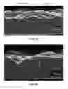 Fig. 06 - Traction surface and methods therefor