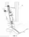 Fig. 02 - Cutting mechanism