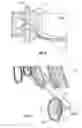Fig. 04 - Method of controlling product volume in a fixed volume mold