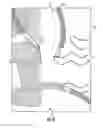 Fig. 07 - Systems and methods for shielding a hand sensor system in a steering wheel