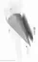 Fig. 08 - Hypersonic laminar flow control