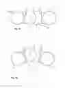 Fig. 06 - Device and method for sterlizing packaging containers by electron beam