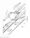 Fig. 07 - Material handling conveyor vehicle