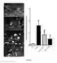 Fig. 16 - Epoxyeicosatrienoic acid analogs and methods of making and using the same