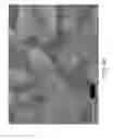 Fig. 45 - Preparations of hydrophobic therapeutic agents, methods of manufacture and use thereof