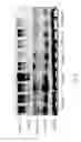 Fig. 15 - Method for treating or preventing liver related diseases