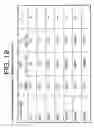 Fig. 24 - Antibodies to IL-6 and use thereof