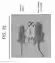Fig. 34 - Antibodies to IL-6 and use thereof