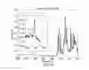 Fig. 06 - Particulate amine-functionalized polyaryletherketone polymer and copolymers thereof