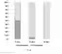 Fig. 19 - COMPOSITION FOR PREVENTING ODORS CONTAINING ORDORLESS MICROORGANISM