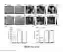Fig. 12 - Extracellular matrix derived from stem cells and methods for production