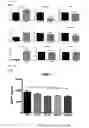 Fig. 13 - Composition comprising ischemic serum for promoting activation of stem cell and method for promoting activation of stem cell