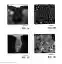 Fig. 02 - Mesenchymal stem cell and the method of use thereof