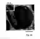 Fig. 04 - Mesenchymal stem cell and the method of use thereof