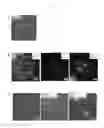 Fig. 08 - REPROGRAMMED STEM CELL