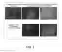 Fig. 02 - Method for production of reprogrammed cell using chromosomally unintegrated virus vector