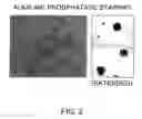 Fig. 03 - Method for production of reprogrammed cell using chromosomally unintegrated virus vector