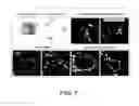 Fig. 08 - Method for production of reprogrammed cell using chromosomally unintegrated virus vector