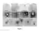 Fig. 02 - BIOMARKERS FOR CHRONIC TRAUMATIC ENCEPHALOPATHY