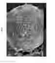 Fig. 06 - Hydride-coated microparticles and methods for making the same