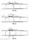 Fig. 04 - STAGE TOOL FOR WELLBORE CEMENTING
