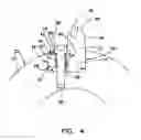 Fig. 05 - Tooth and retainer