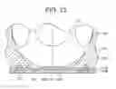 Fig. 10 - Fuel injection valve