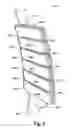 Fig. 02 - Planar non-compressible rigidizable chain assembly