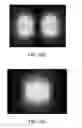 Fig. 03 - Three-dimensional dispersible nanoresonator structure for biological, medical and environmental applications and method for manufacture thereof