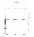 Fig. 06 - Glycoform detection method and glycoform detection device