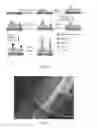 Fig. 20 - EMBODIMENTS OF A COMPOSITION COMPRISING DIATOM FRUSTULES AND A METHOD OF USING