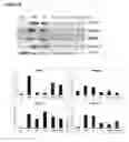 Fig. 06 - METHOD FOR OBTAINING DATA THAT ARE USEFUL FOR THE DIAGNOSIS, PROGNOSIS AND CLASSIFICATION OF PATIENTS WITH CHRONIC OBSTRUCTIVE PULMONARY DISEASE (COPD) AND/OR LUNG CANCER