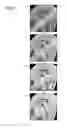 Fig. 08 - Image processing apparatus, magnetic resonance imaging apparatus and image processing method