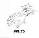 Fig. 08 - TENSIONED AND EXPANDABLES EYEGLASSES