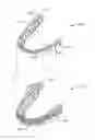 Fig. 01 - Systems and methods for tracking teeth movement during orthodontic treatment
