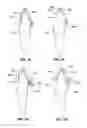 Fig. 08 - Systems and methods for tracking teeth movement during orthodontic treatment
