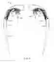 Fig. 06 - Ambient light compensation for augmented or virtual reality