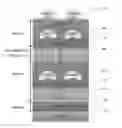 Fig. 01 - Zero-dimensional electron devices and methods of fabricating the same